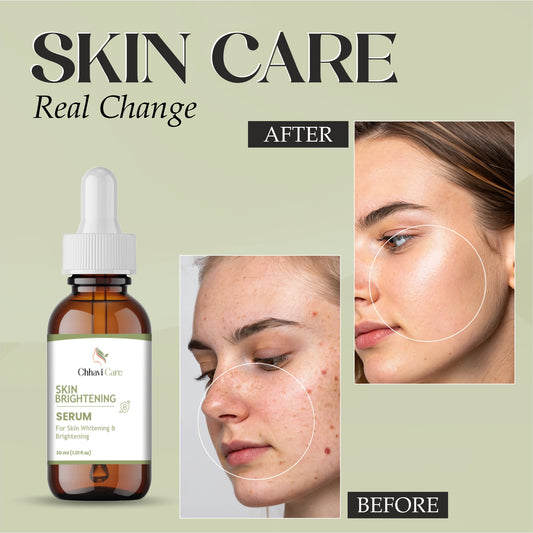 Skin Brightening Serum, Whitening Formula, 30ml Dropper Bottle