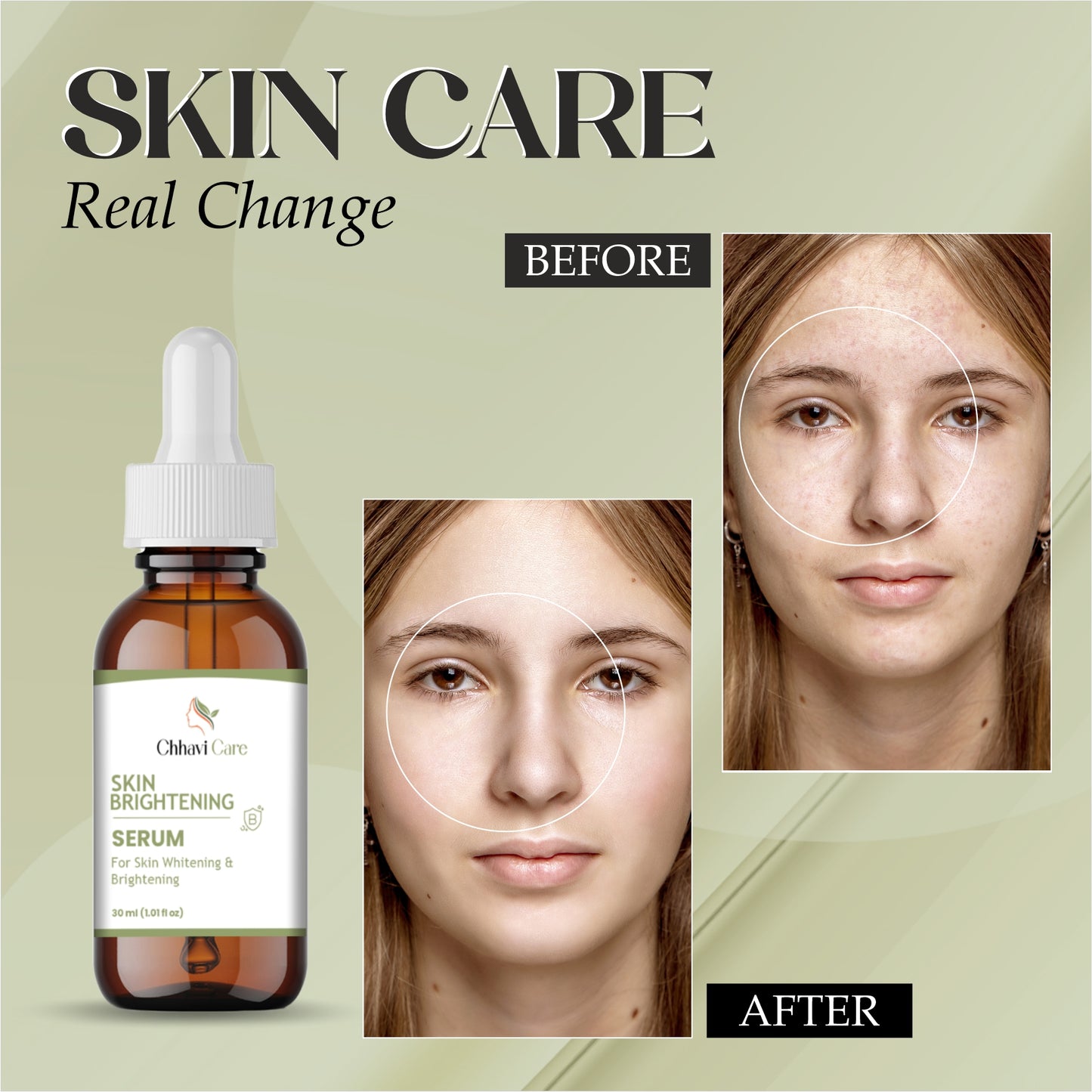 Skin Brightening Serum, Whitening Formula, 30ml Dropper Bottle