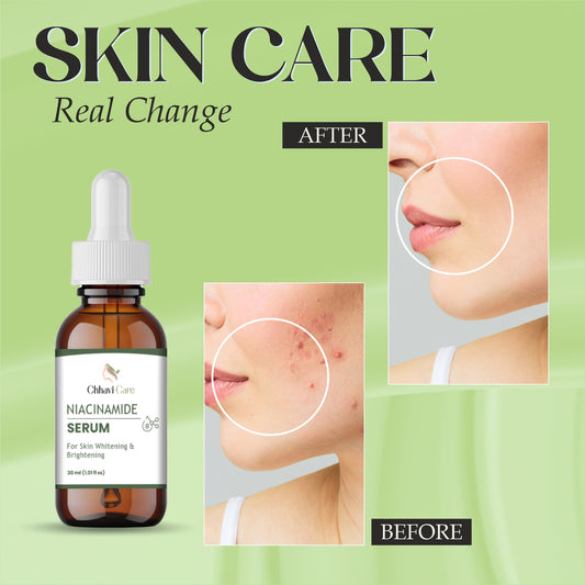 Chhavi care Niacinamide Serum for Skin Whitening and Brightening, 30ml