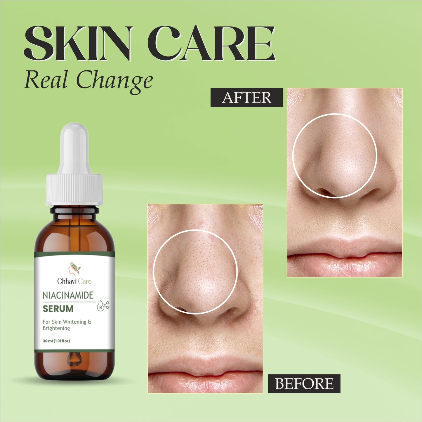 Chhavi care Niacinamide Serum for Skin Whitening and Brightening, 30ml